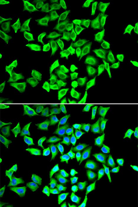 Polyclonal Rabbit anti-Human TP53 / p53 Antibody (IF, WB)