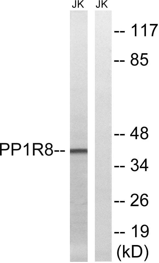 Polyclonal Rabbit anti-Human PPP1R8 / Rnase E Antibody (WB)