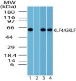 Polyclonal Rabbit anti-Human KLF4 Antibody (aa1-50, WB)