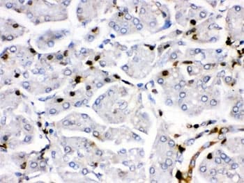 FOSB Antibody