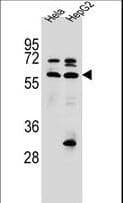 SELN / SEPN1 Antibody (aa417-445)