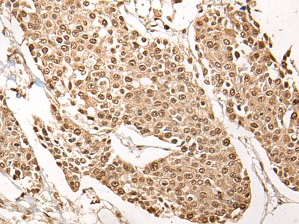 PCNA Antibody