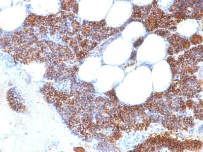 PTH / Parathyroid Hormone Antibody (clone PTH/2295R, Azide-free, Carrier-free)