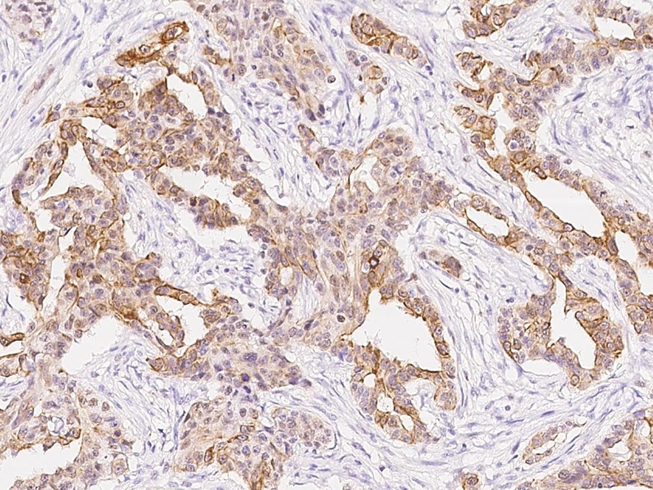 CDK2 Antibody (Preservative Free)