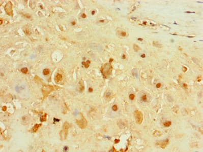 Polyclonal Rabbit anti-Human IFIH1 / MDA5 Antibody