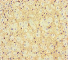 KLHL3 Antibody