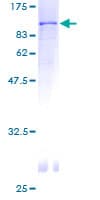 Human SNX2 Protein (Recombinant GST)