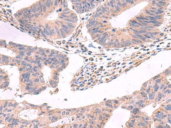 GKAP1 Antibody