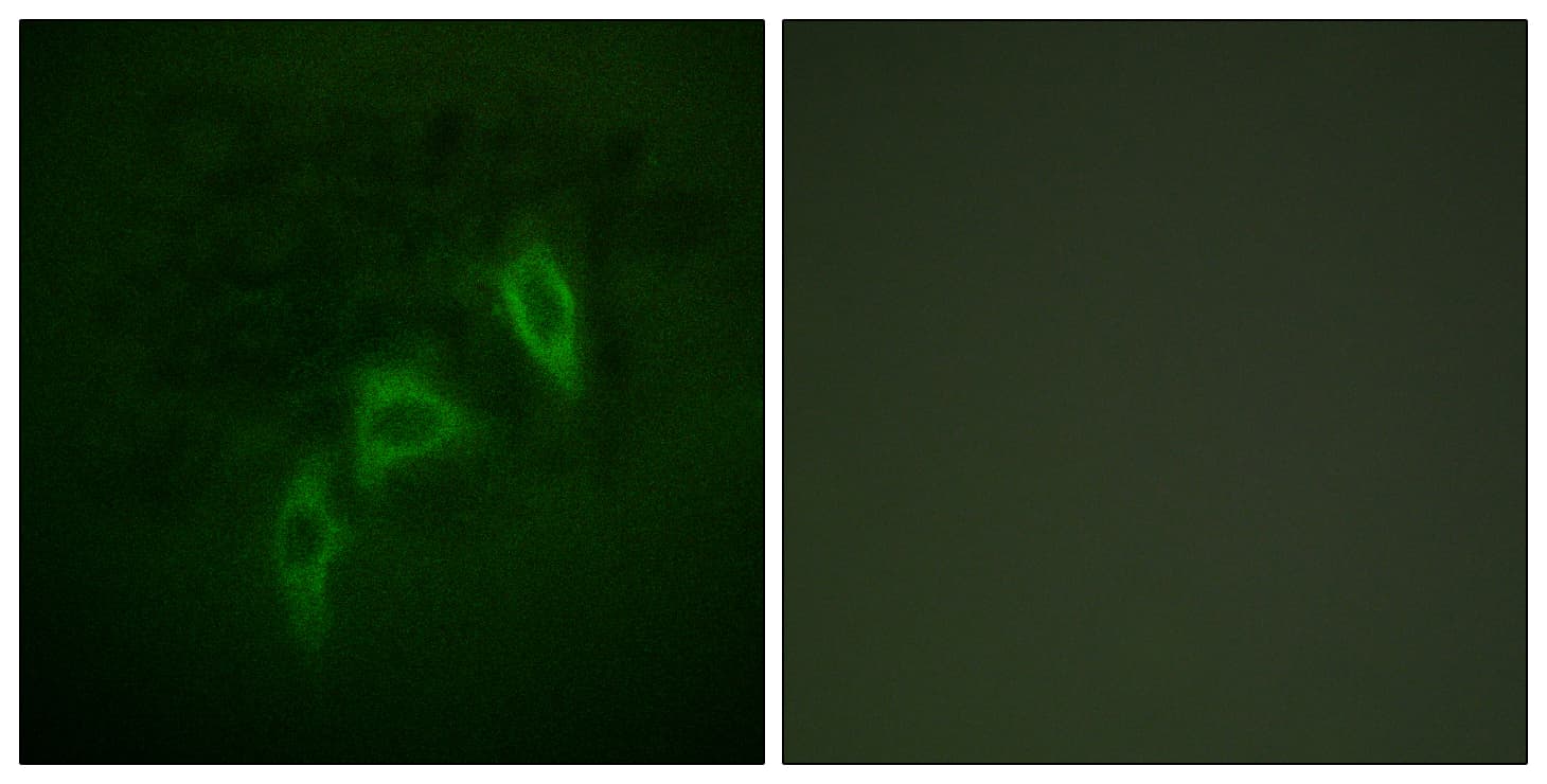Tuberin / TSC2 Antibody (aa905-954)