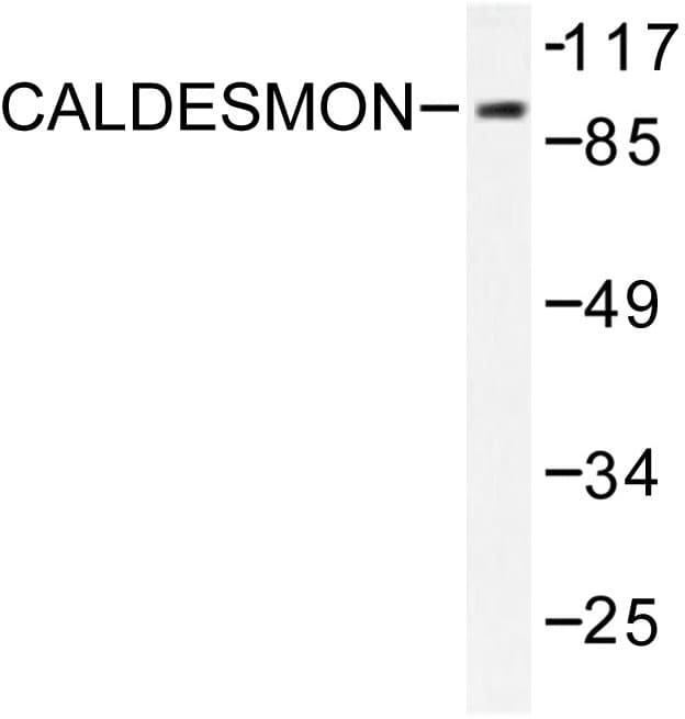 CALD1 / Caldesmon Antibody (Ser783)