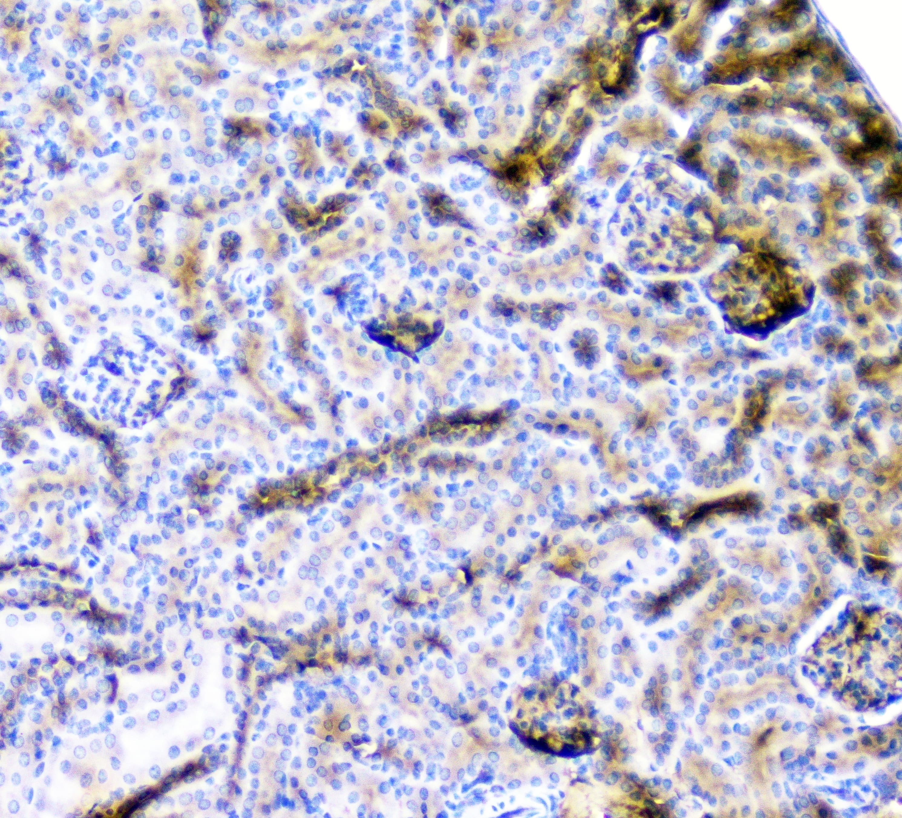 CD2AP Antibody