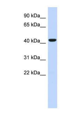 SMS2 / SGMS2 Antibody (aa71-120)