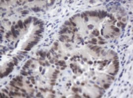 ACD / PTOP Antibody (clone OTI2B1)