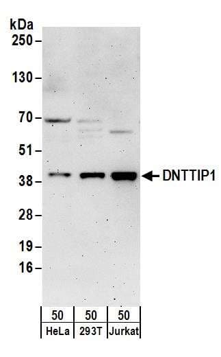 IHC-plus™ Polyclonal Rabbit anti-Human ZNF423 / OAZ Antibody (aa250-300, IHC, WB)