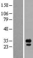 FGF14 Protein (Over-Expression Lysate Myc-DDK (Flag))