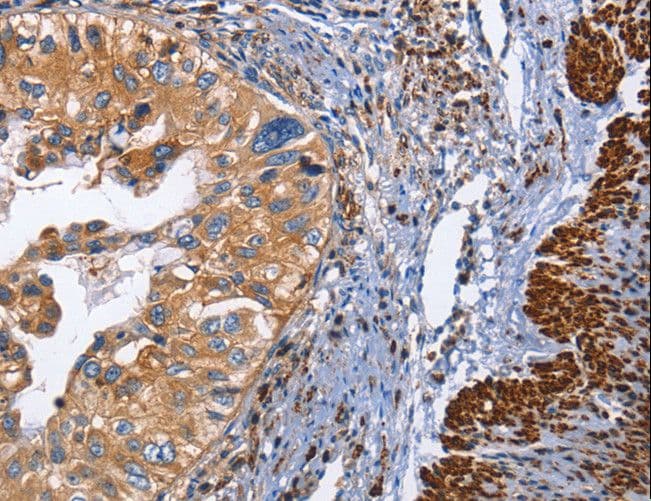 CD45 / LCA Antibody