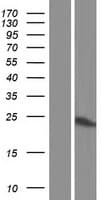 PSMB9 Protein (Over-Expression Lysate Myc-DDK (Flag))