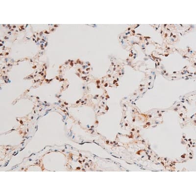 MAPK8 / JNK1 Antibody (phospho-Thr183,pTyr185)