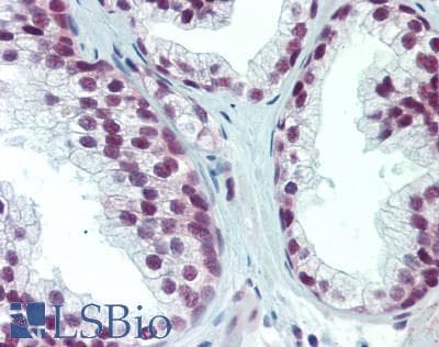 IHC-plus™ SAFB1 / SAFB Antibody (aa775-825)
