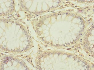 ADGRE5 / CD97 Antibody