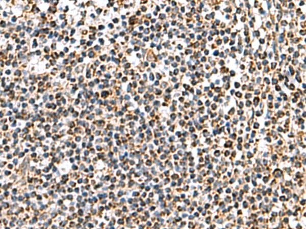 Polyclonal Rabbit anti-Human AP1S3 Antibody (IHC)