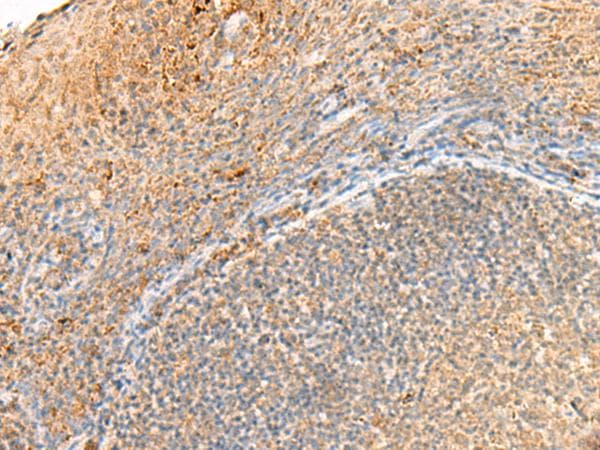 GPR161 Antibody