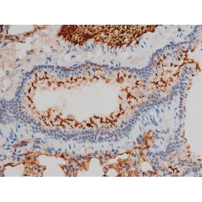 EZR / Ezrin Antibody (phospho-Tyr478)