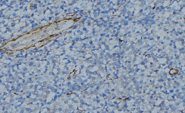 Polyclonal Rabbit anti-Human C1QG / Complement C1QC Antibody (IHC, WB)