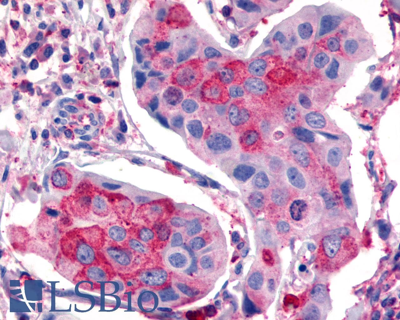 IHC-plus™ FZD2 / Frizzled 2 Antibody (Extracellular Domain)