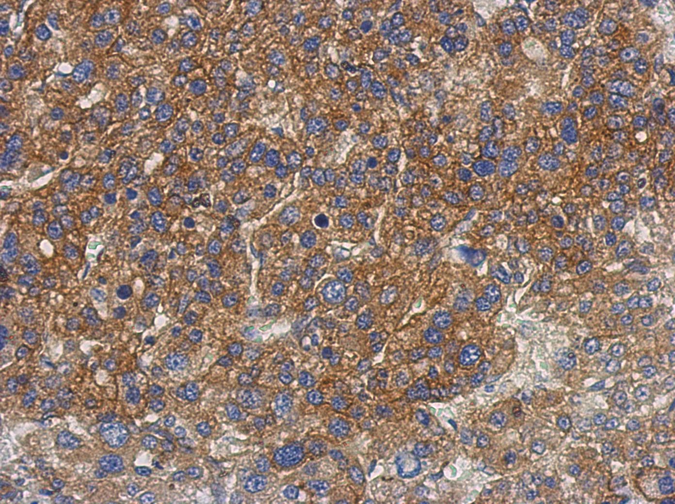 Polyclonal Rabbit anti-Human PNPLA4 Antibody (IHC, WB)