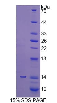 Human PLOD3 Protein (Recombinant His)