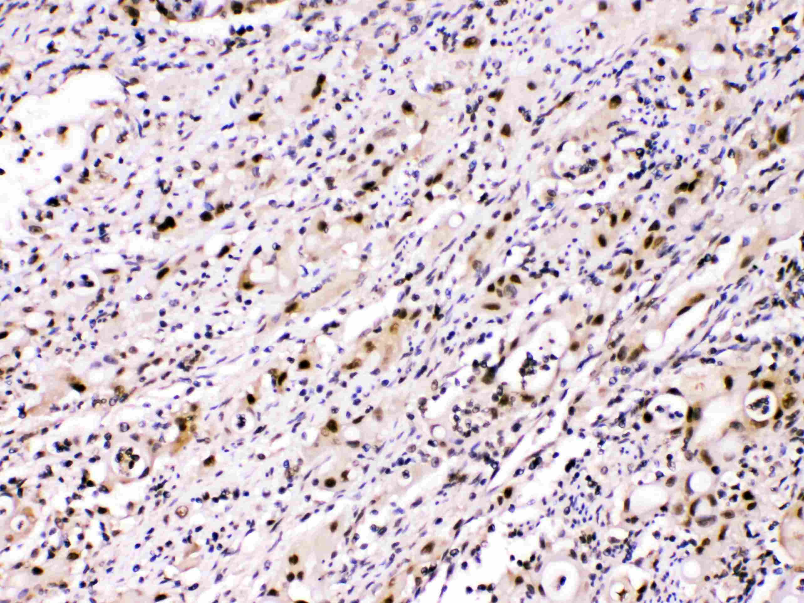 ACLY / ATP Citrate Lyase Antibody