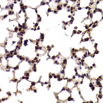 SF1 Antibody