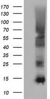 FSHB / FSH Beta Antibody (clone OTI1B2)