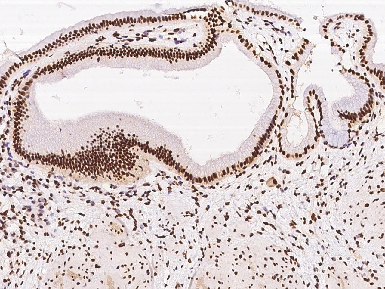 ZNF782 Antibody
