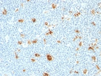 Calgranulin A/B Antibody (clone CAGB/426)