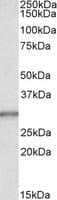 IHC-plus™ CA1 / Carbonic Anhydrase I Antibody (aa166-176)
