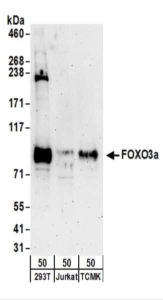 Polyclonal Rabbit anti-Human FOXO3 / FOXO3A Antibody (aa250-300, IHC, WB)