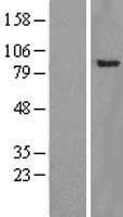 YY1AP1 Protein (Over-Expression Lysate Myc-DDK (Flag))