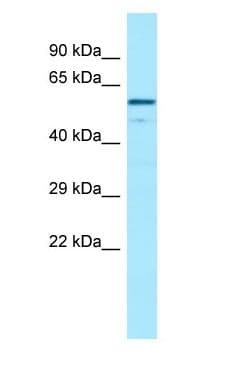 CFHR4 Antibody (aa501-550)