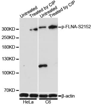 FLNA / Filamin A Antibody (phospho-Ser2152)