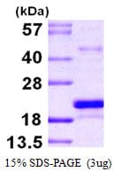 Human MSRB3 Protein (Recombinant His)
