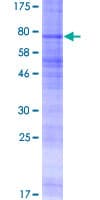 Human SSTR3 Protein (Recombinant GST)