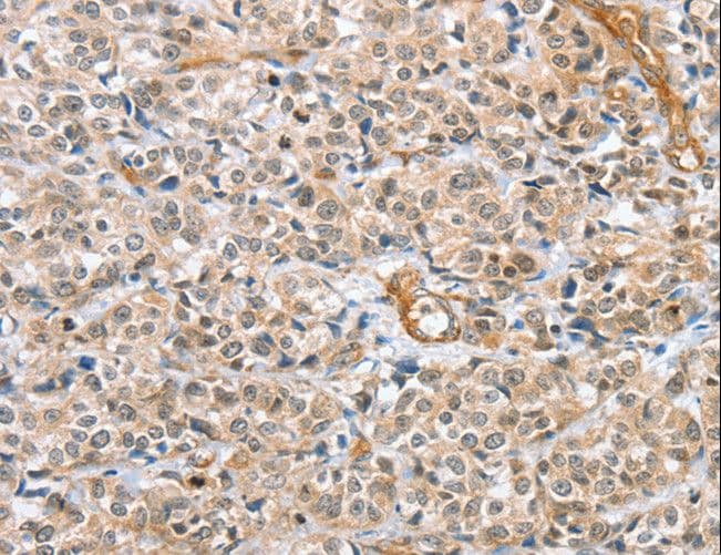 CENPC / CENP-C Antibody