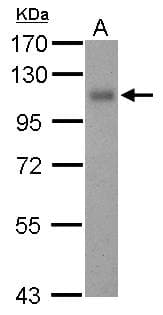PathPlus™ THBD / CD141 / Thrombomodulin Antibody (C-Terminus)