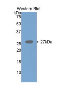 CD71 / Transferrin Receptor Antibody (aa567-744, Cy3)