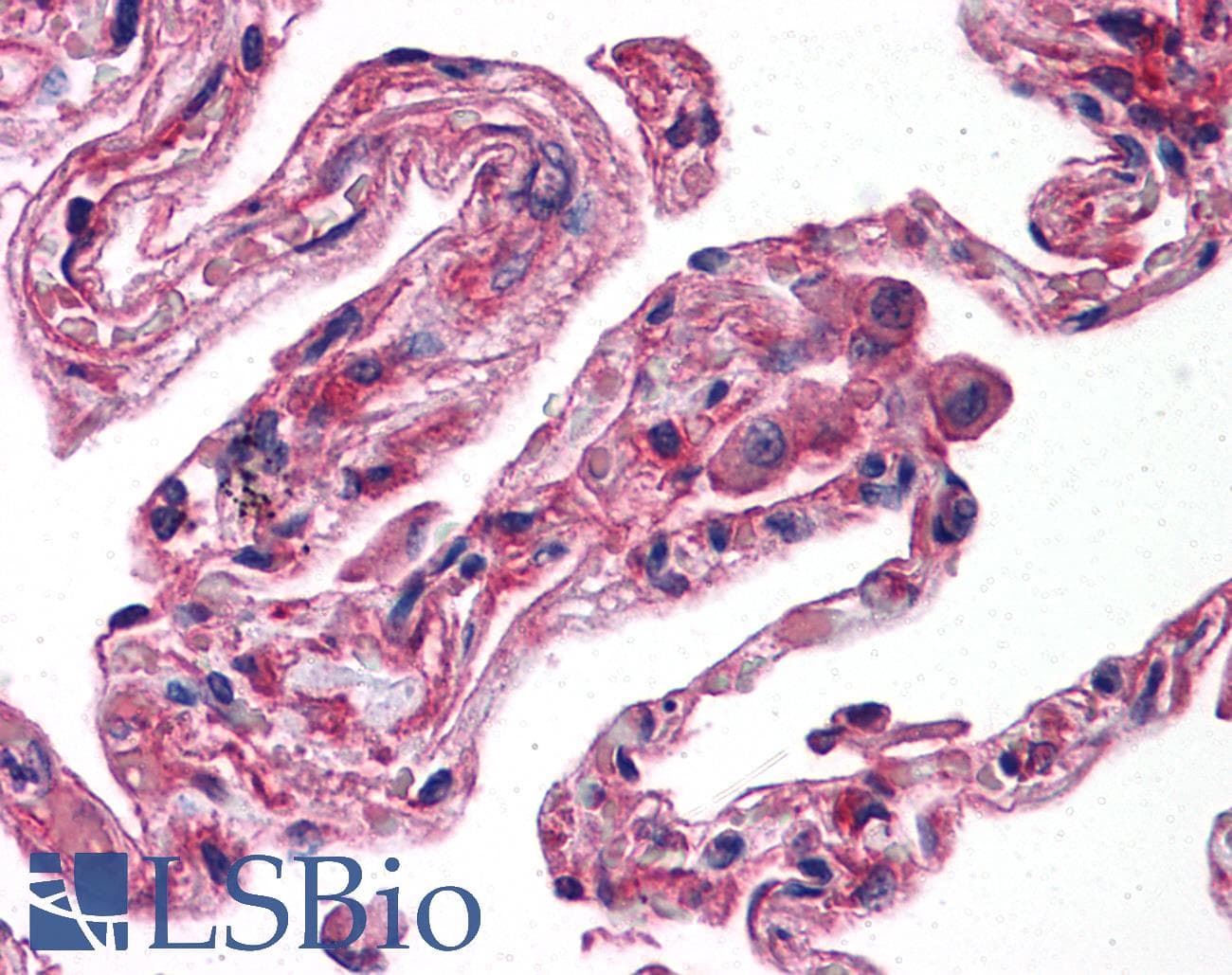 IHC-plus™ Monoclonal Mouse anti-Human ERN1 / IRE1 Antibody (clone 9F2, IHC, WB)