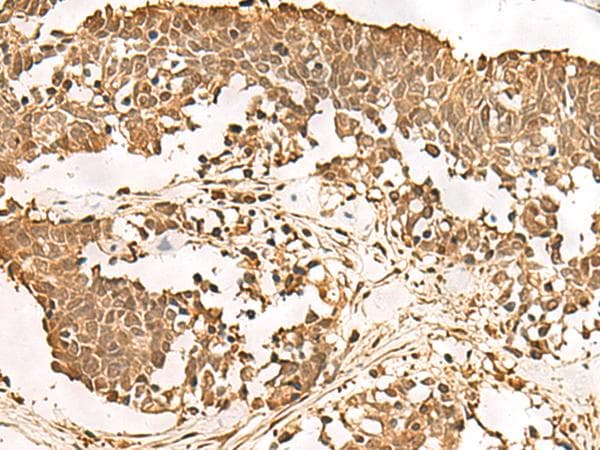 PSMA3 Antibody