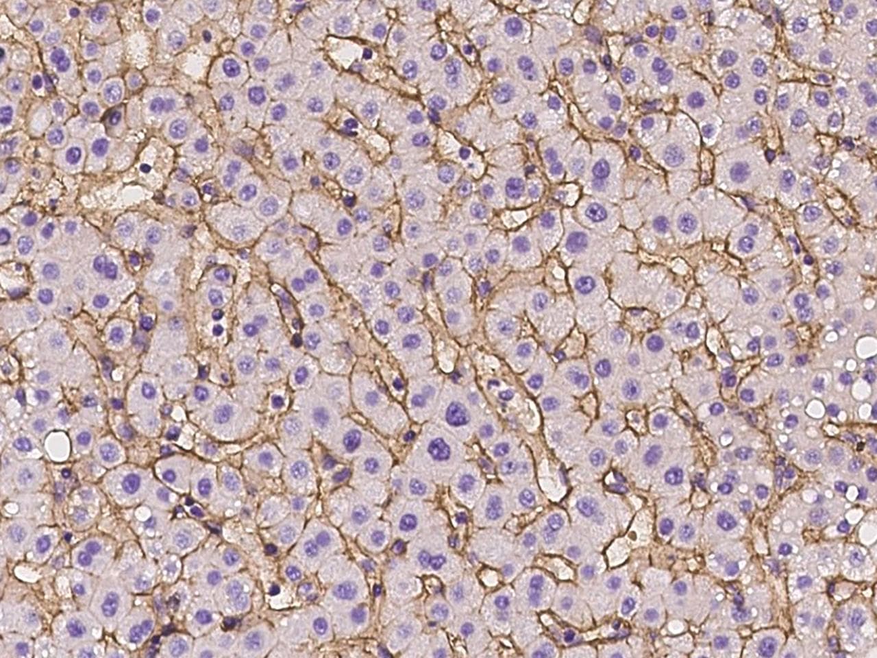 CD81 Antibody