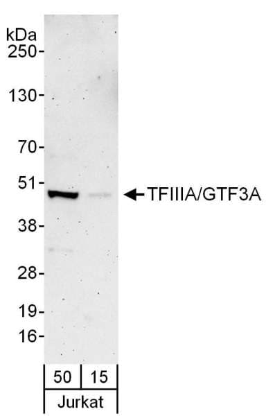 IHC-plus™ Polyclonal Rabbit anti-Human GTF3A Antibody (aa1-50, IHC, WB)